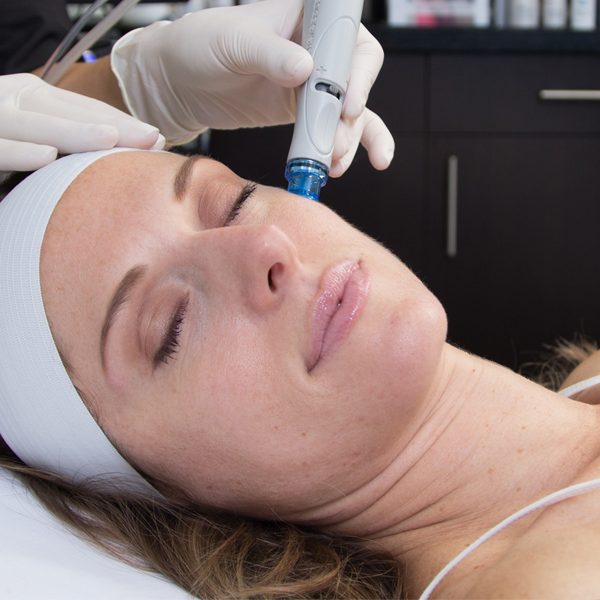 Spa Facials, Peels, and Professional Skin Care, Valencia, California